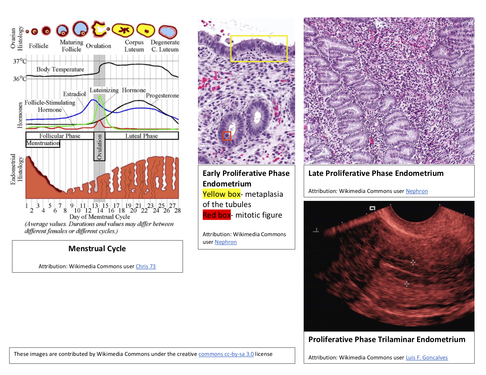 Images of the proliferative phase endometrium and the menstrual cycle.