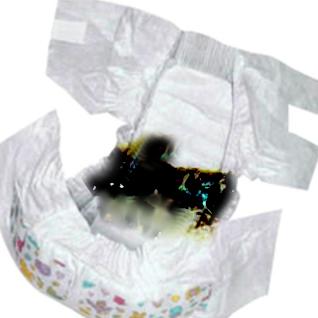 Meconium stained diaper