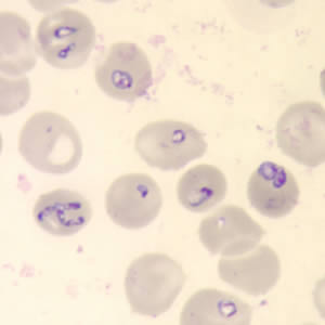 Thin blood smear stained with Giemsa.