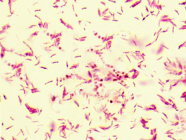 Mycobacterium kansasii