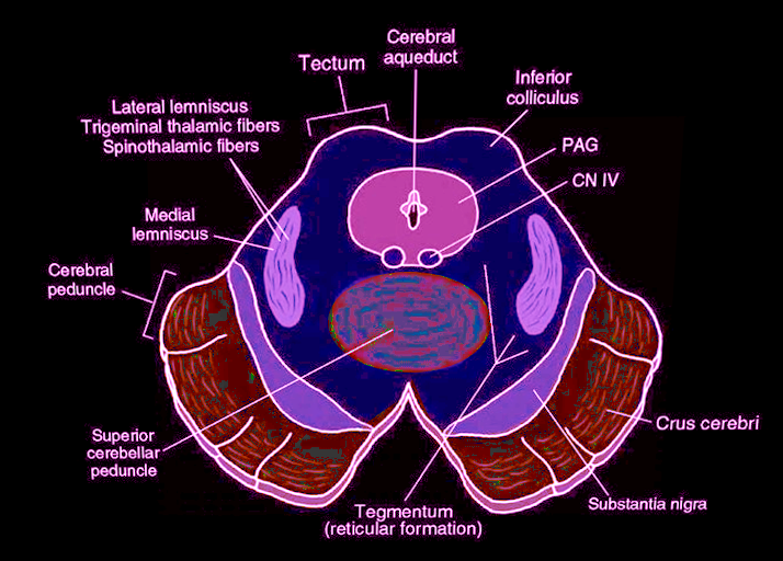 Midbrain cross sectional anatomy