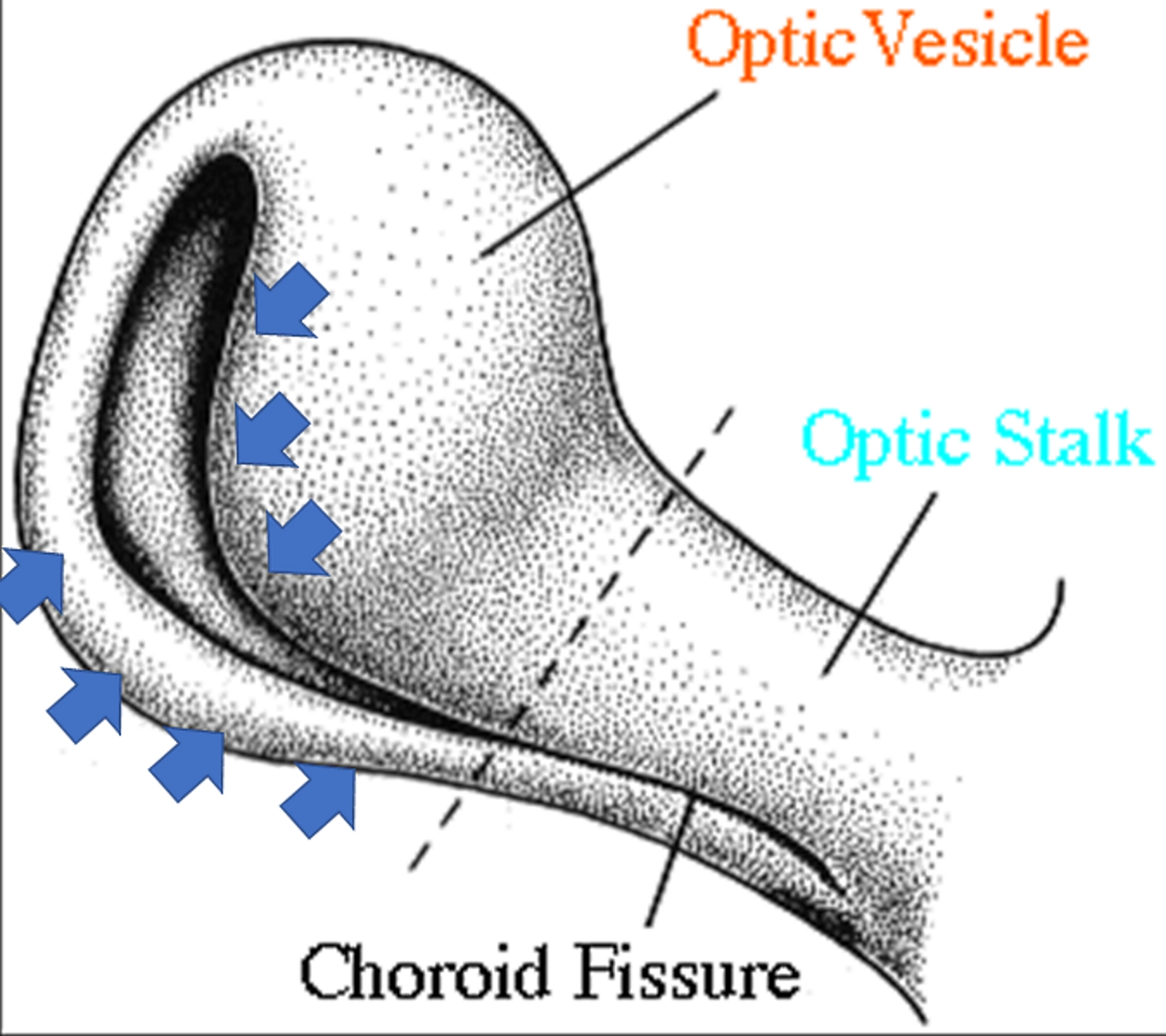 The figure shows the invagination process of the optic stalk and the optic vesicle, with the formation of the choroid fissure (inferiorly). The blue arrows indicate the direction and area of the invagination.