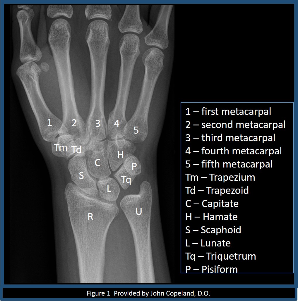 Wrist x-ray with labeled osseous anatomy