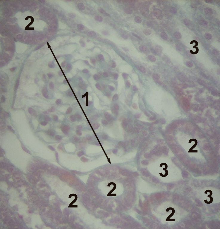 histology of the cortex of a kidney, Nephron Histology, 
1 Glomerulum, 2 proximal tubule, 3 distal tubule