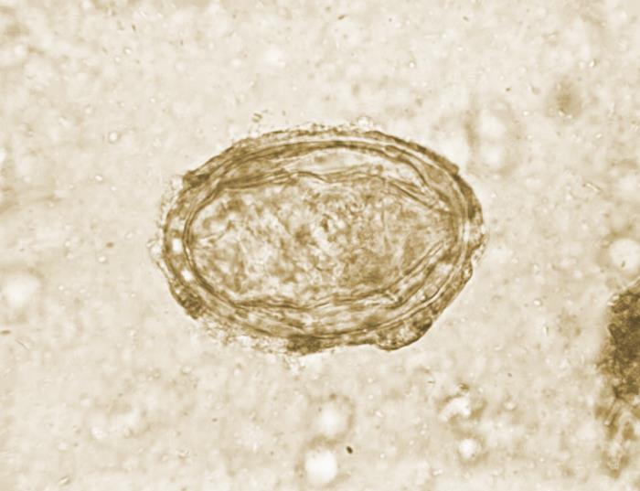 This photomicrograph reveals ultrastructural details exhibited by a single Schistosoma japonicum ovum. S. japonicum is one of the trematodes that causes the parasitic disease schistosomiasis. Its egg displays a vestigial, laterally protruding spine, which is more of a remnant of a spine than a distinct spine. Schistosomiasis infections are diagnosed when the presence of their eggs in the urine or stool sample is confirmed.