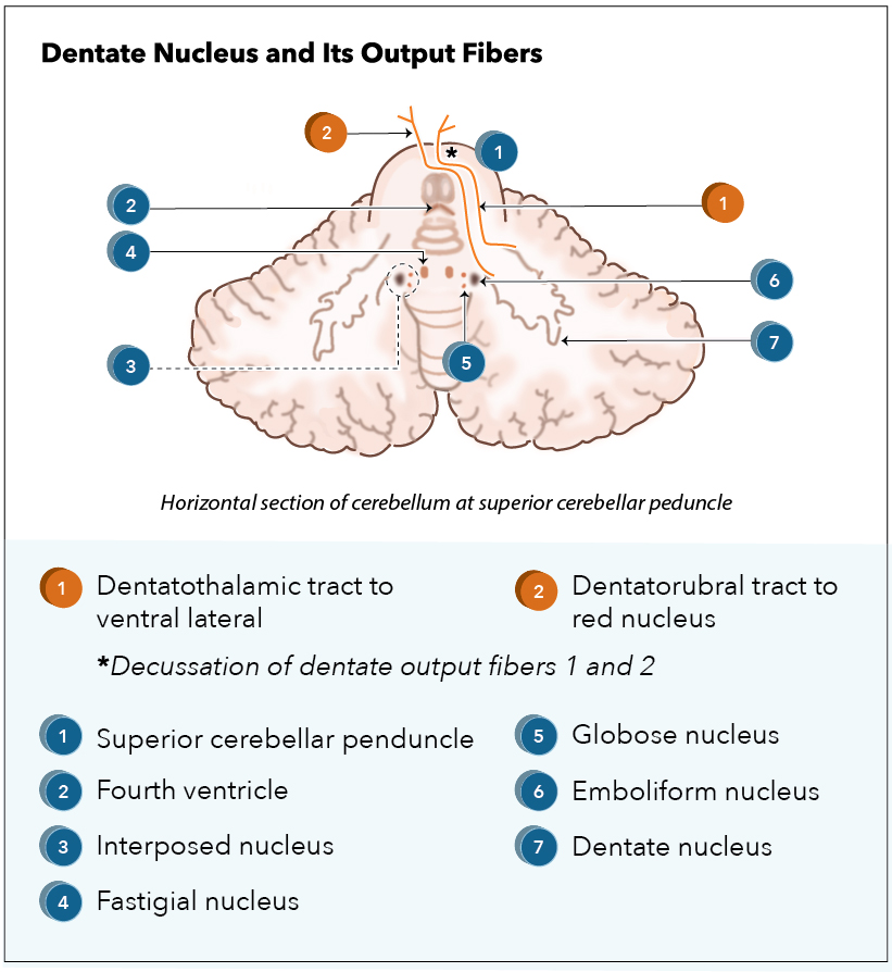 <p>Dentate nucleus</p>