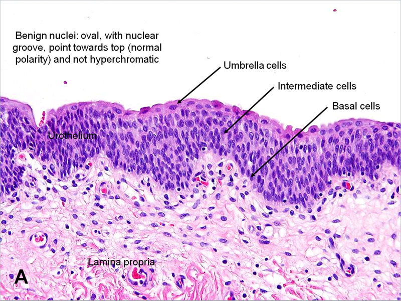 benign urothelial cells, histology