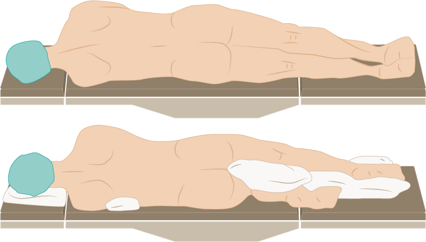 Lateral Decubitus Position