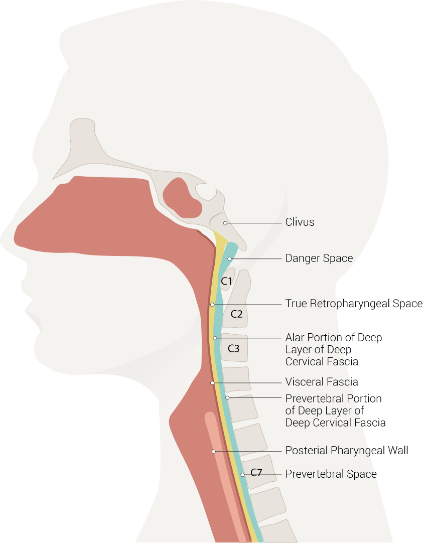 <p>Neck Spaces Pertinent to Retropharyngeal Abscess