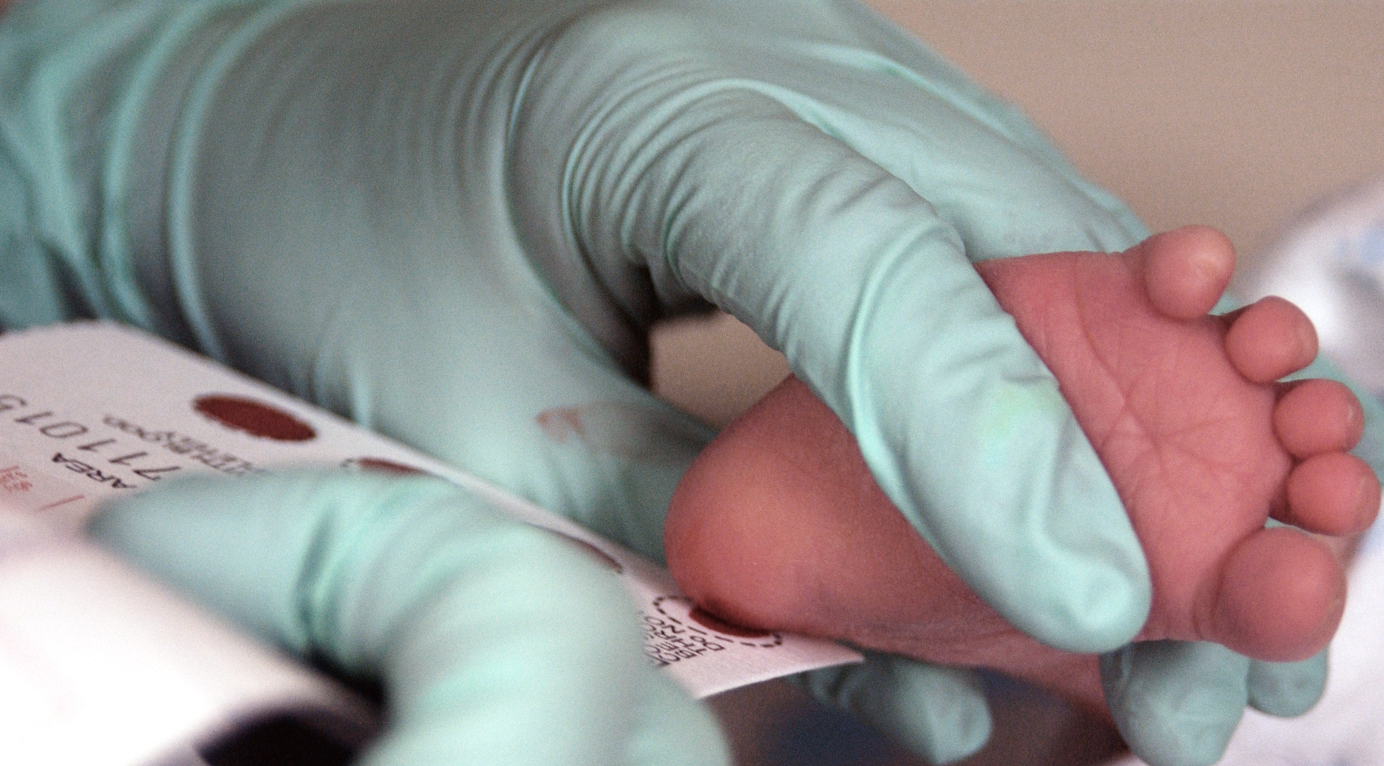 Newborn screening with blood obtained from heel prick