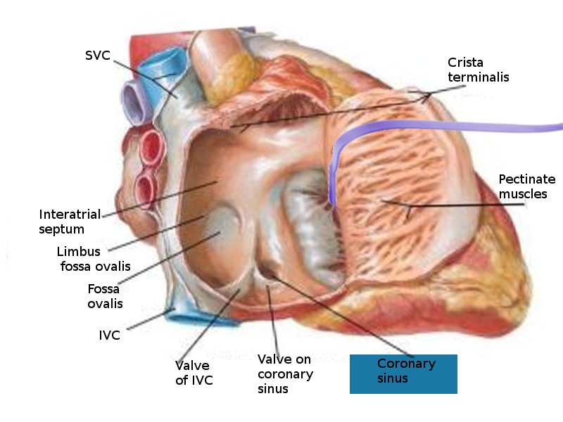Coronary sinus opening