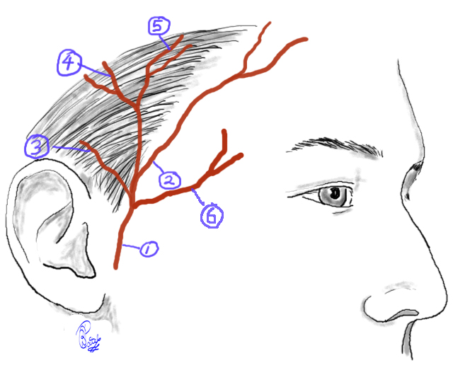 Superficial Temporal Artery: 1. Superficial Temporal Artery 2. Anterior (frontal) branch 3. Anterior auricular branch 4 & 5. Parietal branches 6. Middle temporal 