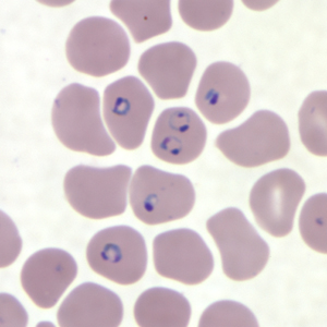 Rings of P. falciparum in a thin blood smear.