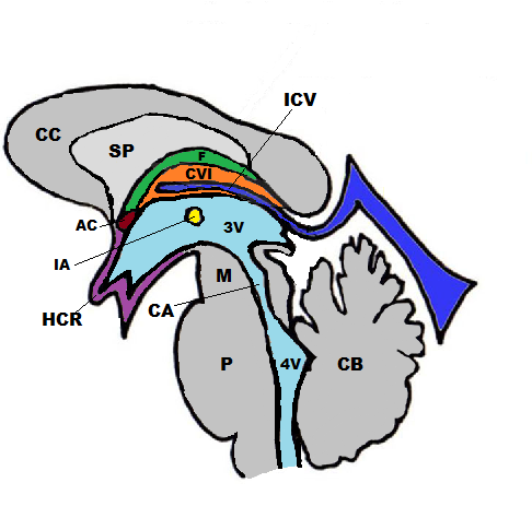 <p>Sagittal Schematic View,&nbsp;Cavum Veli Interpositi