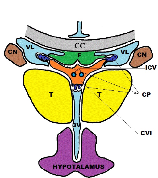 <p>Coronal Schematic View,&nbsp;Cavum Veli Interpositi
