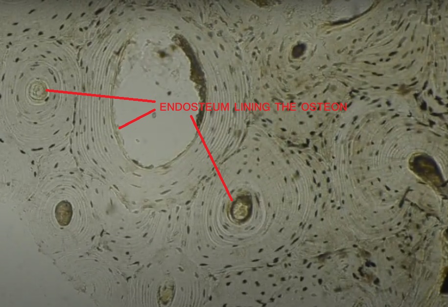 Endosteum lining the osteon in ground section of the compact bone