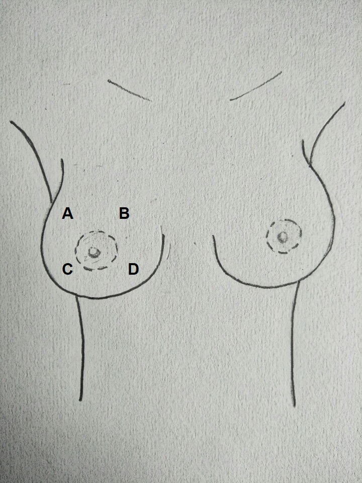 Breast quadrants schematic