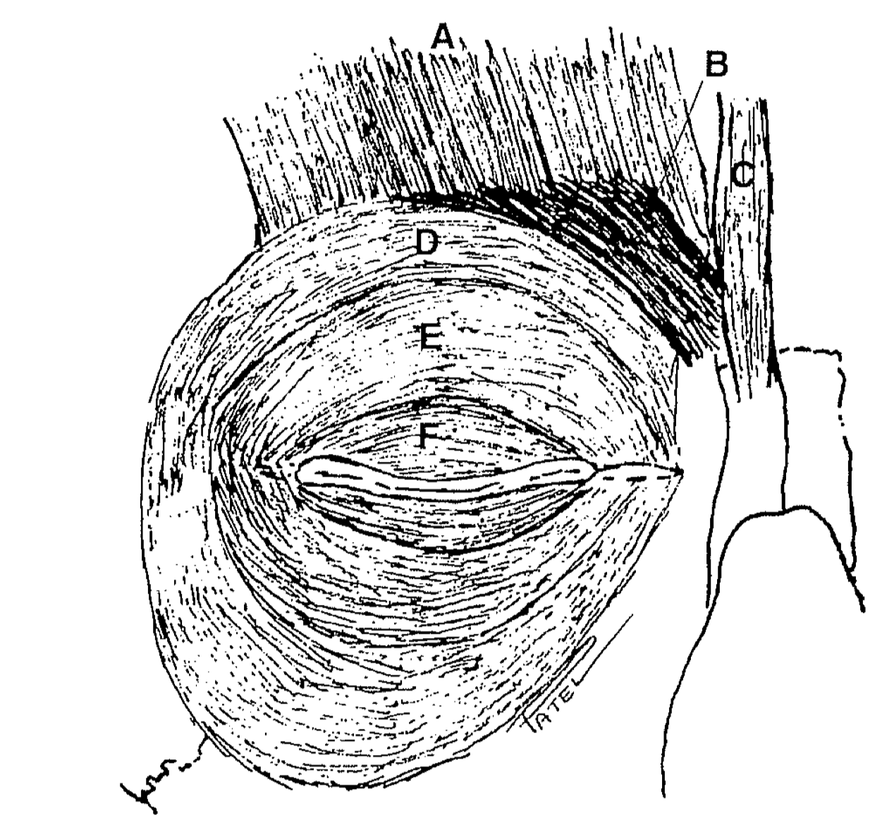 Orbicularis Oculi Muscle and its relations: 

A: Frontalis muscle
B: Corrugator superciliaris muscle
C: Procerus muscle
D: Orbital orbicularis muscle
E: Preseptal orbicularis muscle
F: Pretarsal orbicularis muscle