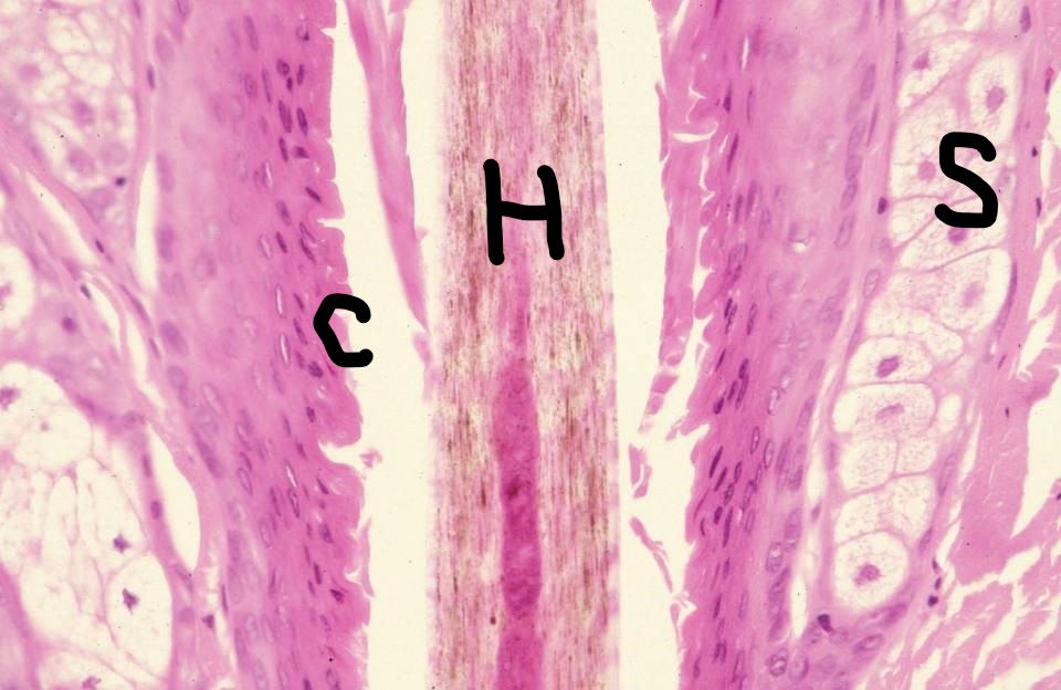 Pilosebaceous unit.  The hair shaft (H) is present within the follicle.  The sebaceous glands (S) connect to the follicle at its mid-portion, where there is an eosinophilic cuticle lining (C).  