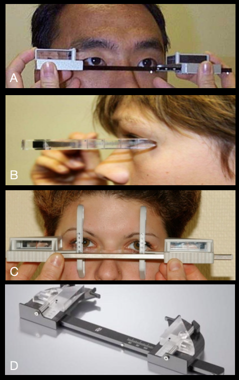 Enophthalmos: the different types of exophthalmometers used to measure the globe position.
A: the Hertel exophthalmometer
B: the Leudde exophthalmometer
C: the Naugle exophthalmometer
D: the Mourits exophthalmometer