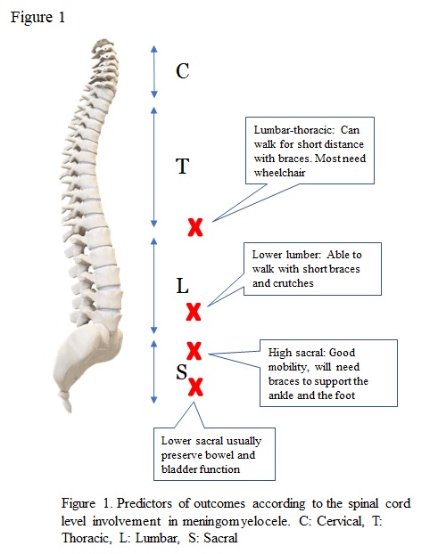 Figure 1. Predictors of outcomes according to the spinal cord level involvement in meningomyelocele. C: Cervical, T: Thoracic, L: Lumbar, S: Sacral.