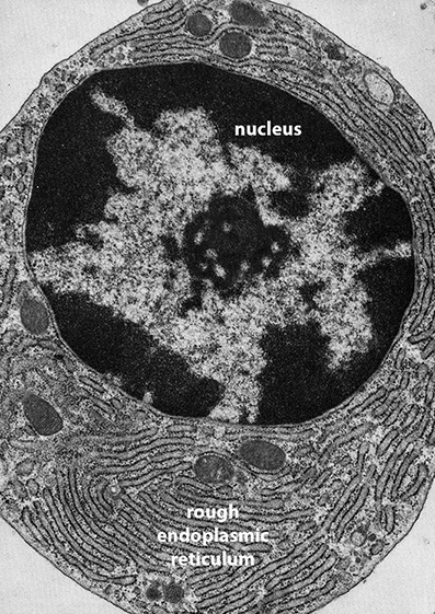 Transmission Electron Micrograph of Rough Endoplasmic Reticulum