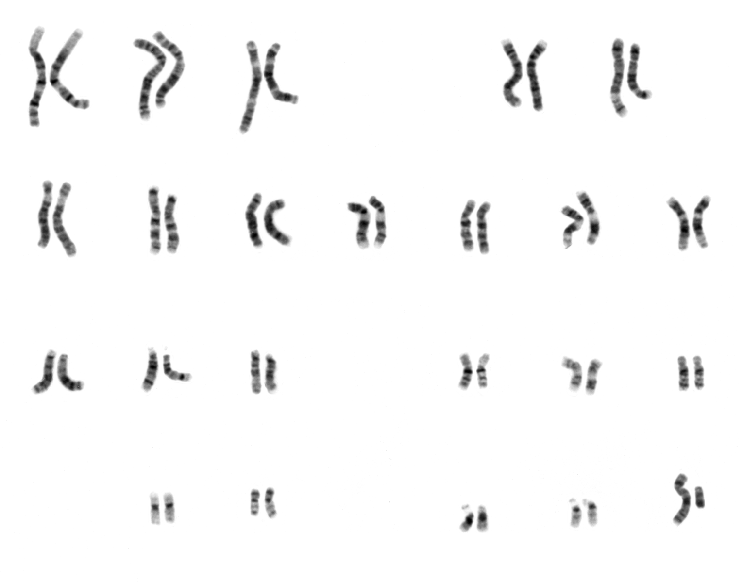 Human male karyotype