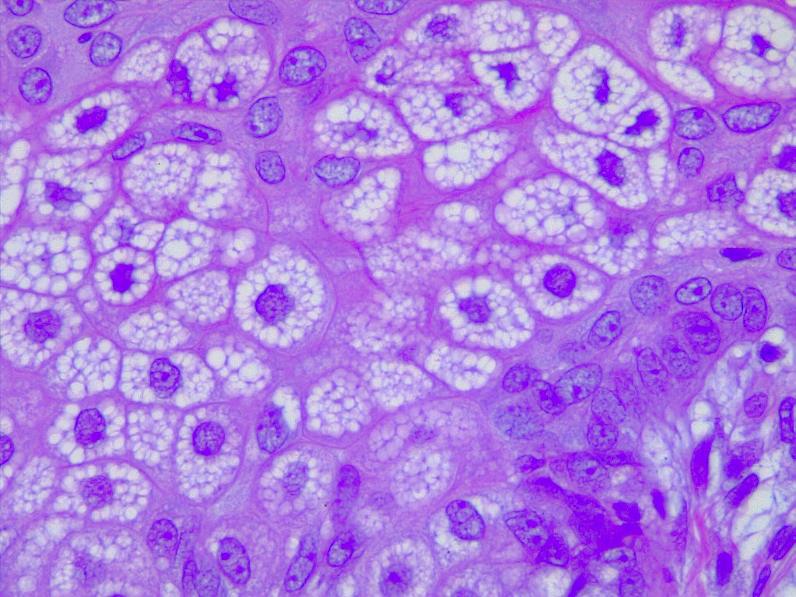 <p>Sebocytes, Sebaceous Gland Cells. H/E 40x Magnification.</p>