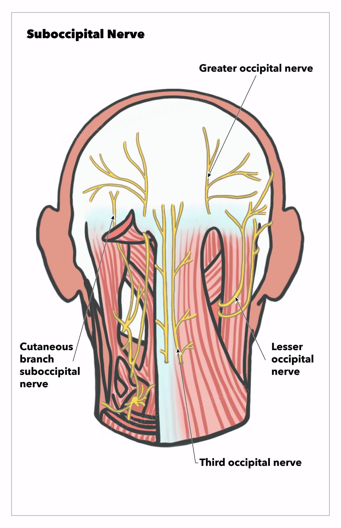 Suboccipital Nerve, Greater occipital nerve, Cutaneous branch suboccipital nerve, Lesser occipital nerve, Third occipital nerve