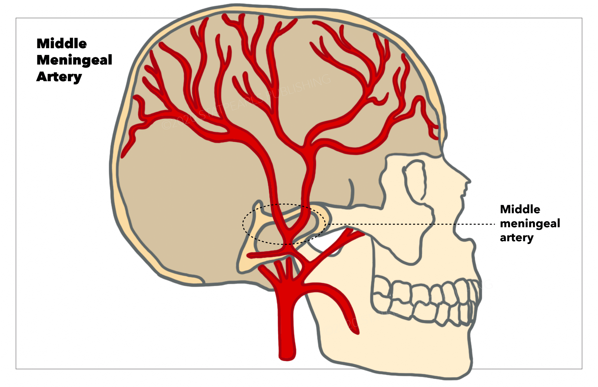 Middle Meningeal Artery
