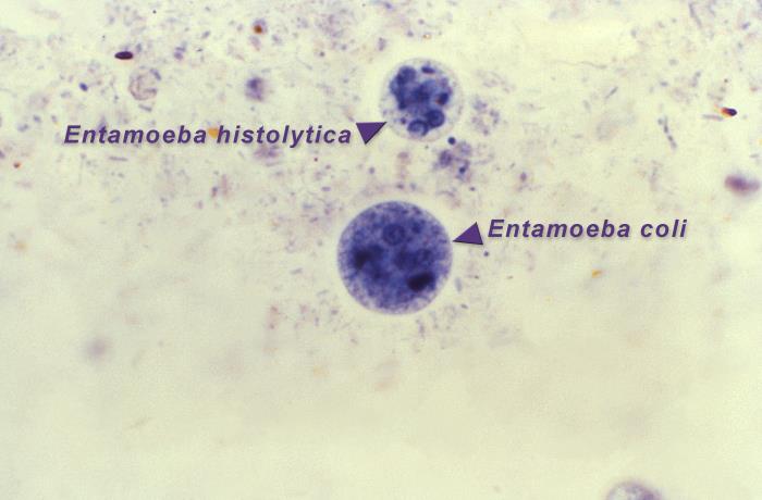 This photomicrograph of an iron-hematoxylin-stained specimen, revealed the presence of two amoebic organisms in their cystic stages of their development. In this focal plane, the smaller Entamoeba histolytica cyst (top), contained four nuclei, and two bluntly-tipped chromatoid bodies, while six nuclei could be detected in the larger Entamoeba coli cyst (bottom), which also contained two chromatoid bodies as well.