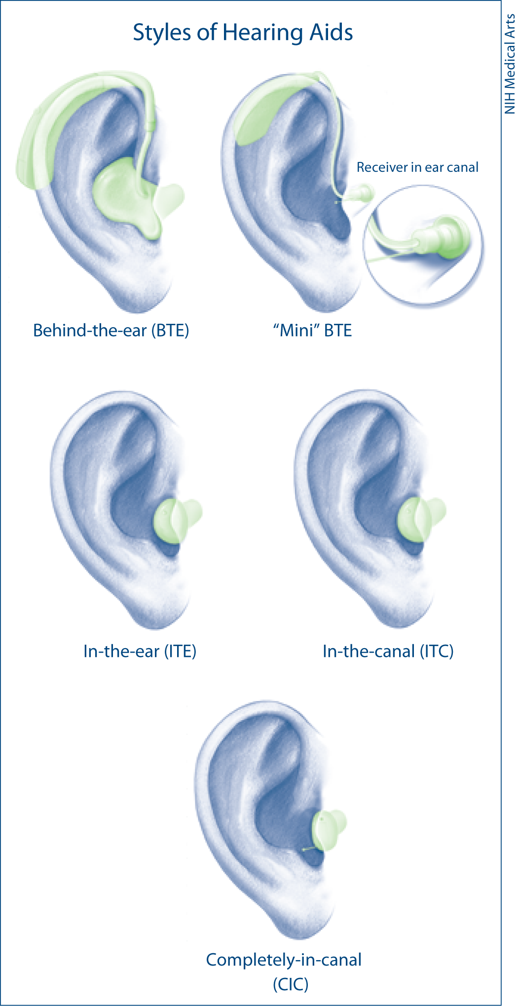 Figure showing different types of hearing aid.