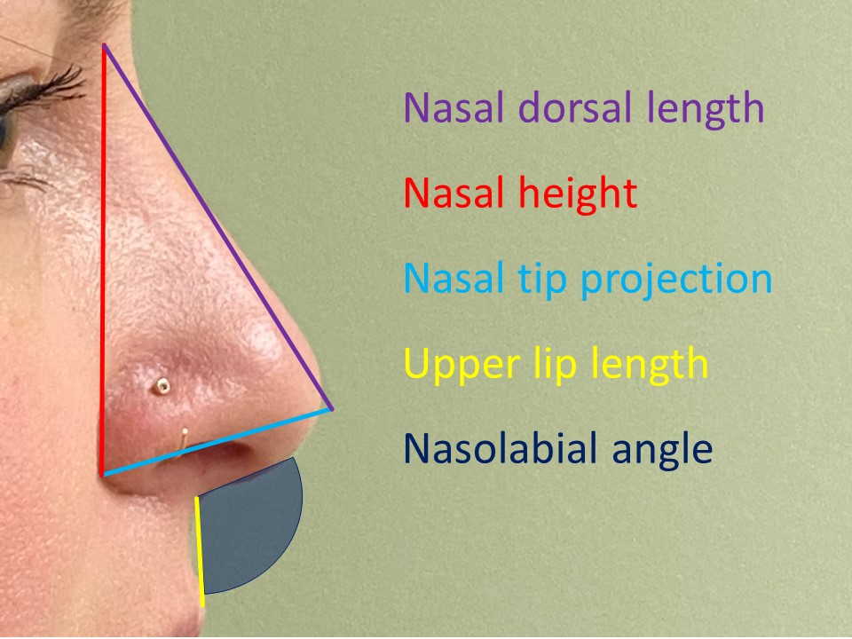 Definitions of nasal measurements. In an ideal nose in a white person, the ratio of the projection to the height to the length should be 3:4:5.