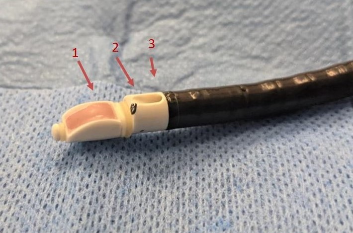 Convex endobronchial ultrasound scope labelled to demonstrate the side viewing ultrasound transducer (1), the forward facing fibreoptic bronchoscope (2), and the working channel (3).
