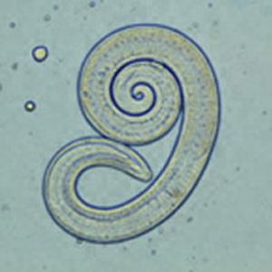 Trichinella Larvae