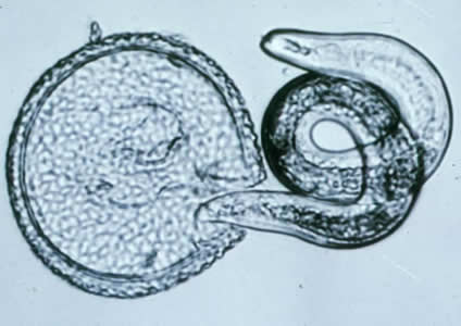 Toxocara egg larva
