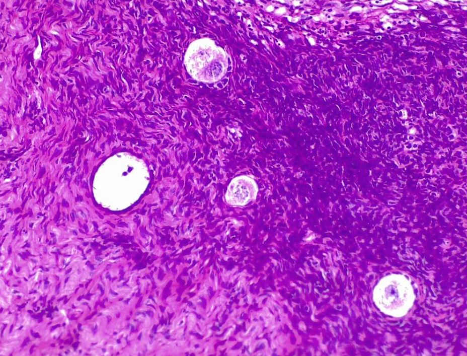 Ovarian follicles, oocytes and a small primary follicle in development.