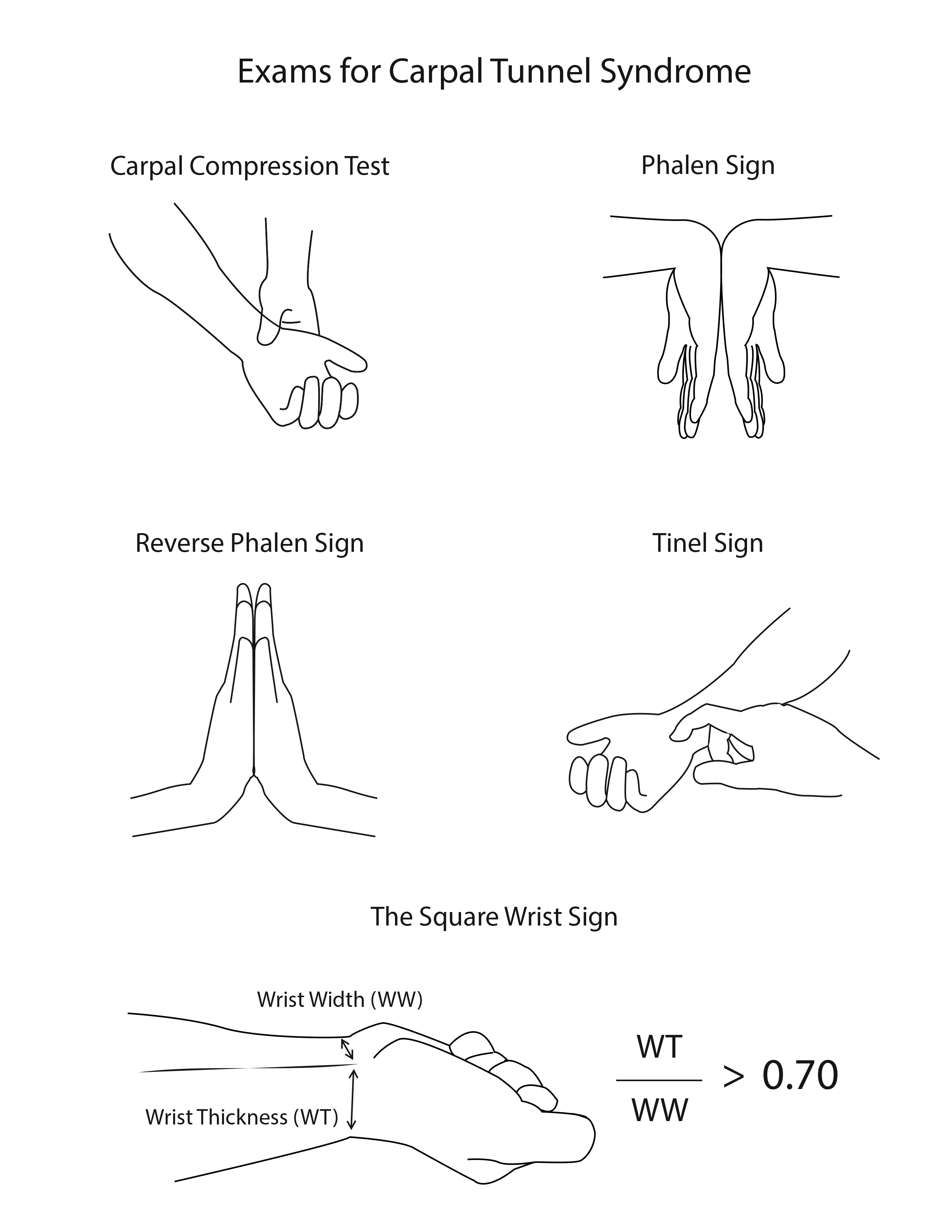 Physical exam maneuvers that test for carpal tunnel syndrome.