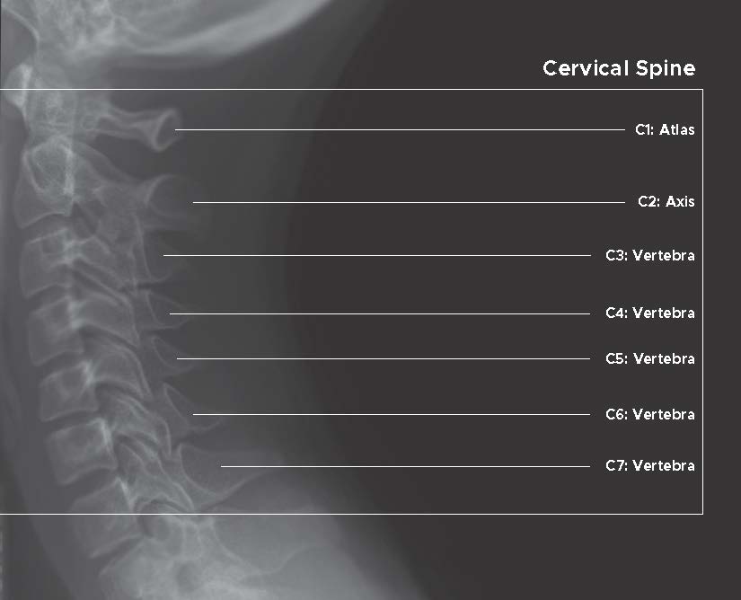 X-ray image of cervical spine