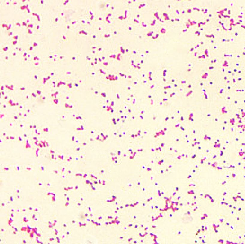Gram stain showing brucella, a gram-negative bacteria. They are small single cells that are poorly stained.