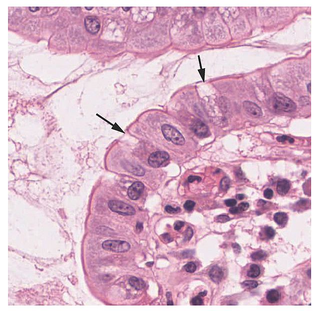 Histology showing goblet cells.