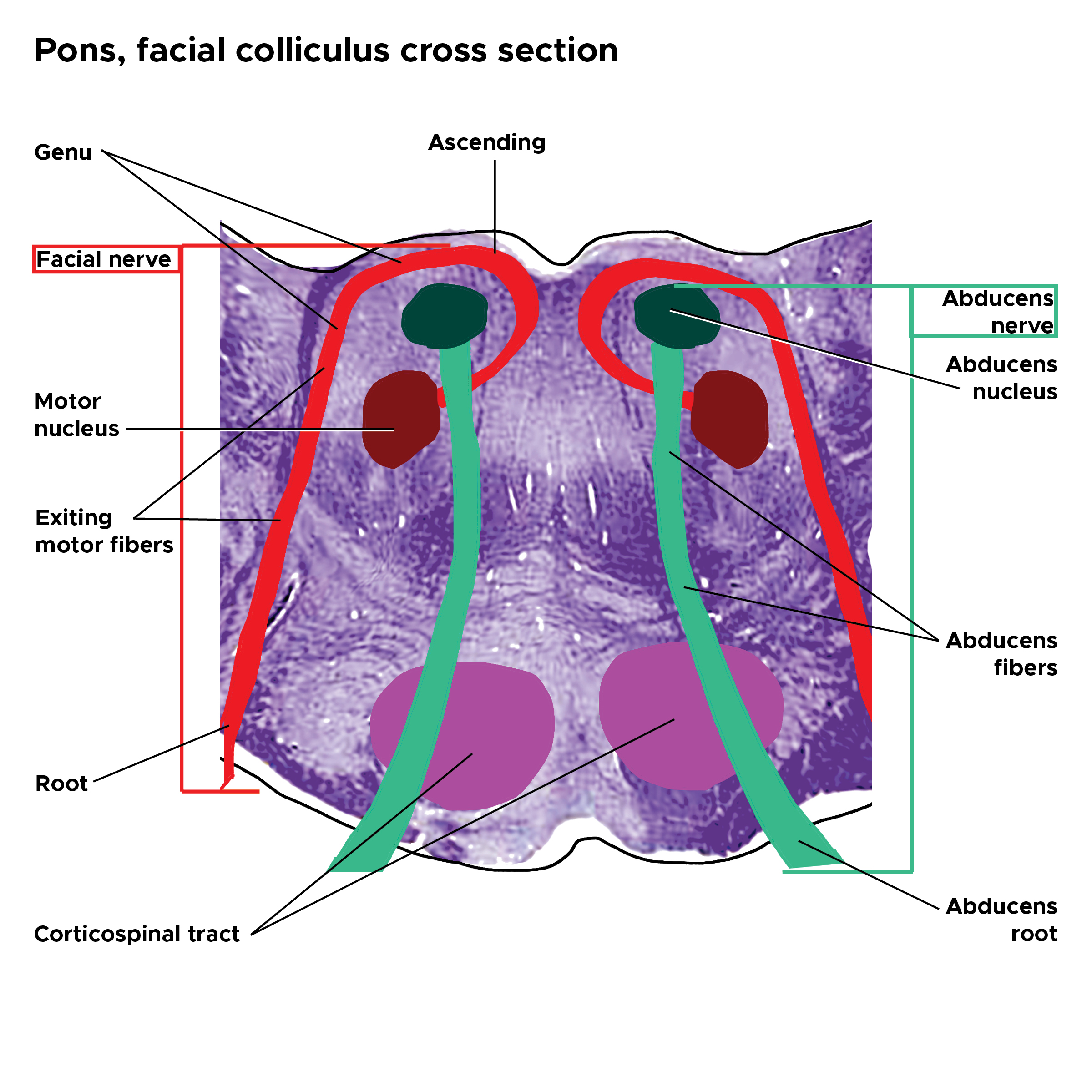 Illustration of cross section of the pons at the facial colliculus. Facial nerve, fibers and nucleus; abducens nerve, fibers and nucleus.