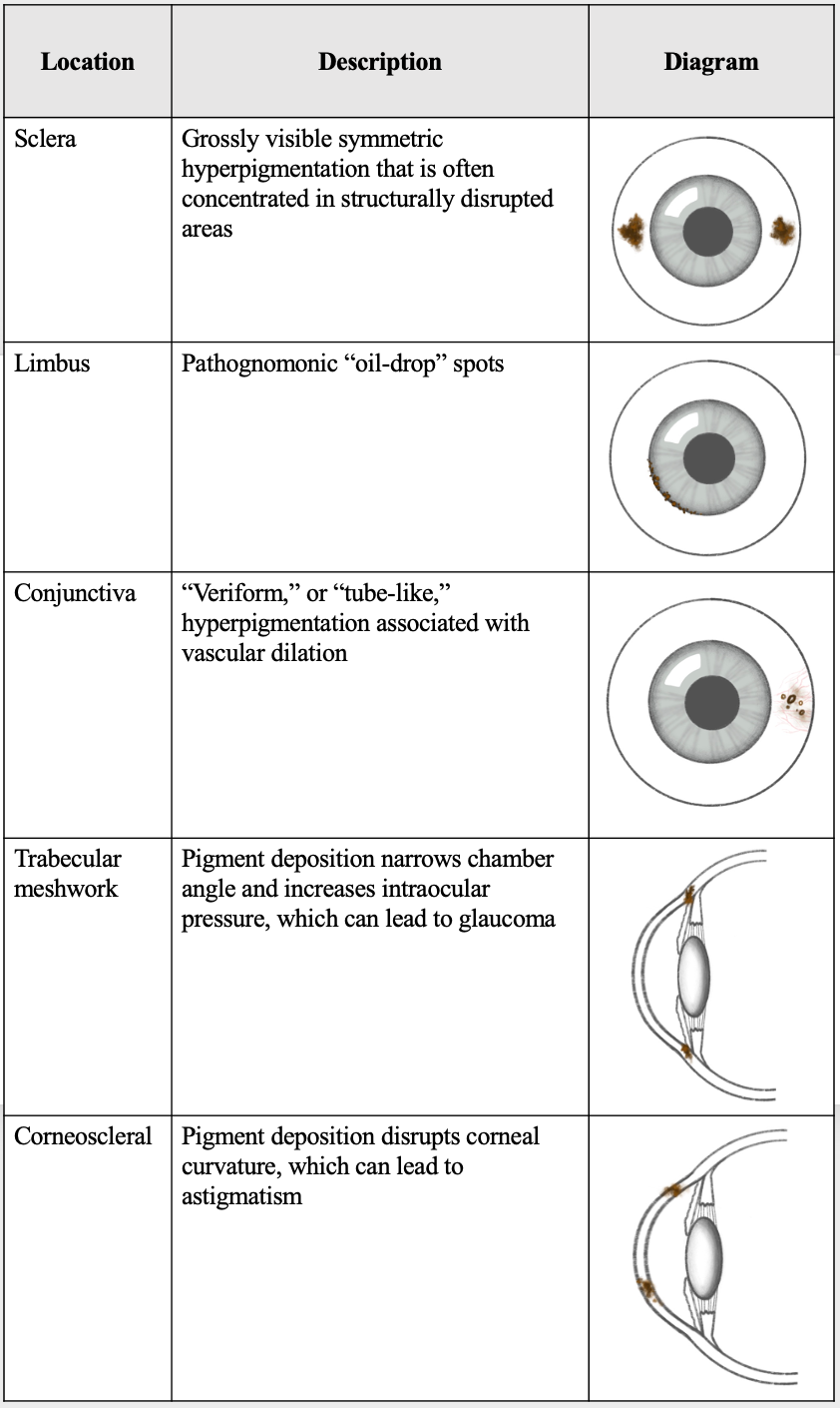 Locations of ocular ochronosis