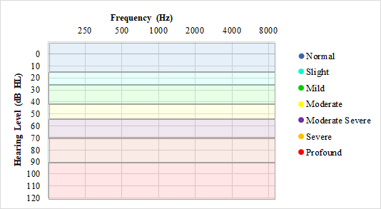 Normal hearing ranges for audiograms.