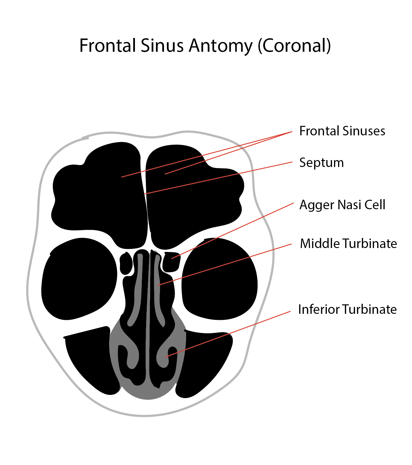 Diagram of the frontal sinus anatomy, coronal view.