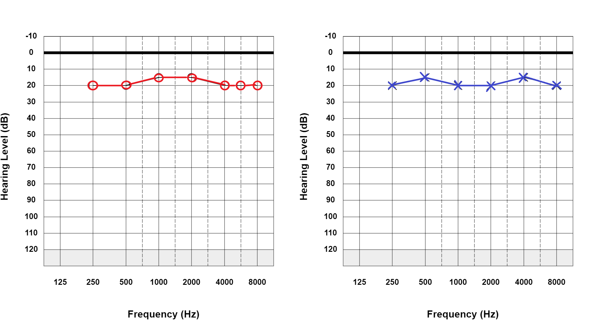 Pure tone audiogram showing normal hearing thresholds. This does not require masking.