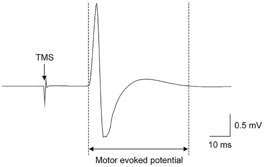 Motor Evoked Potential Waveform