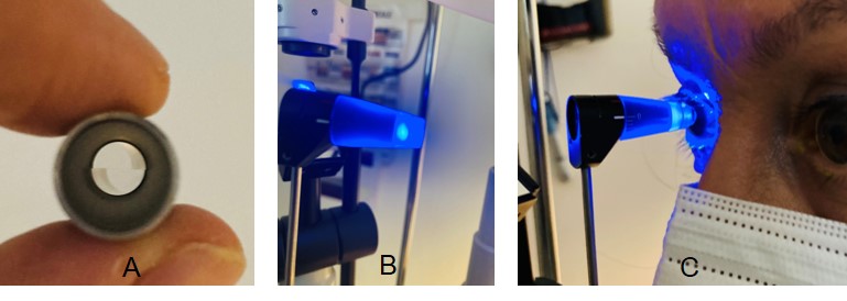 A tip with a split-image prism (A) is used with the Goldmann Applanation Tonometer (GAT), which is mounted on a slit-lamp (B). Filtered cobalt blue light is used during the measurement. The tip is positioned on the center of the eye to gently flatten the cornea (C).