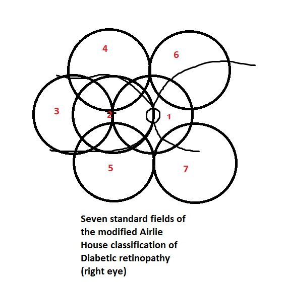 Standard seven fields of the modified Airlie House classification of diabetic retinopathy