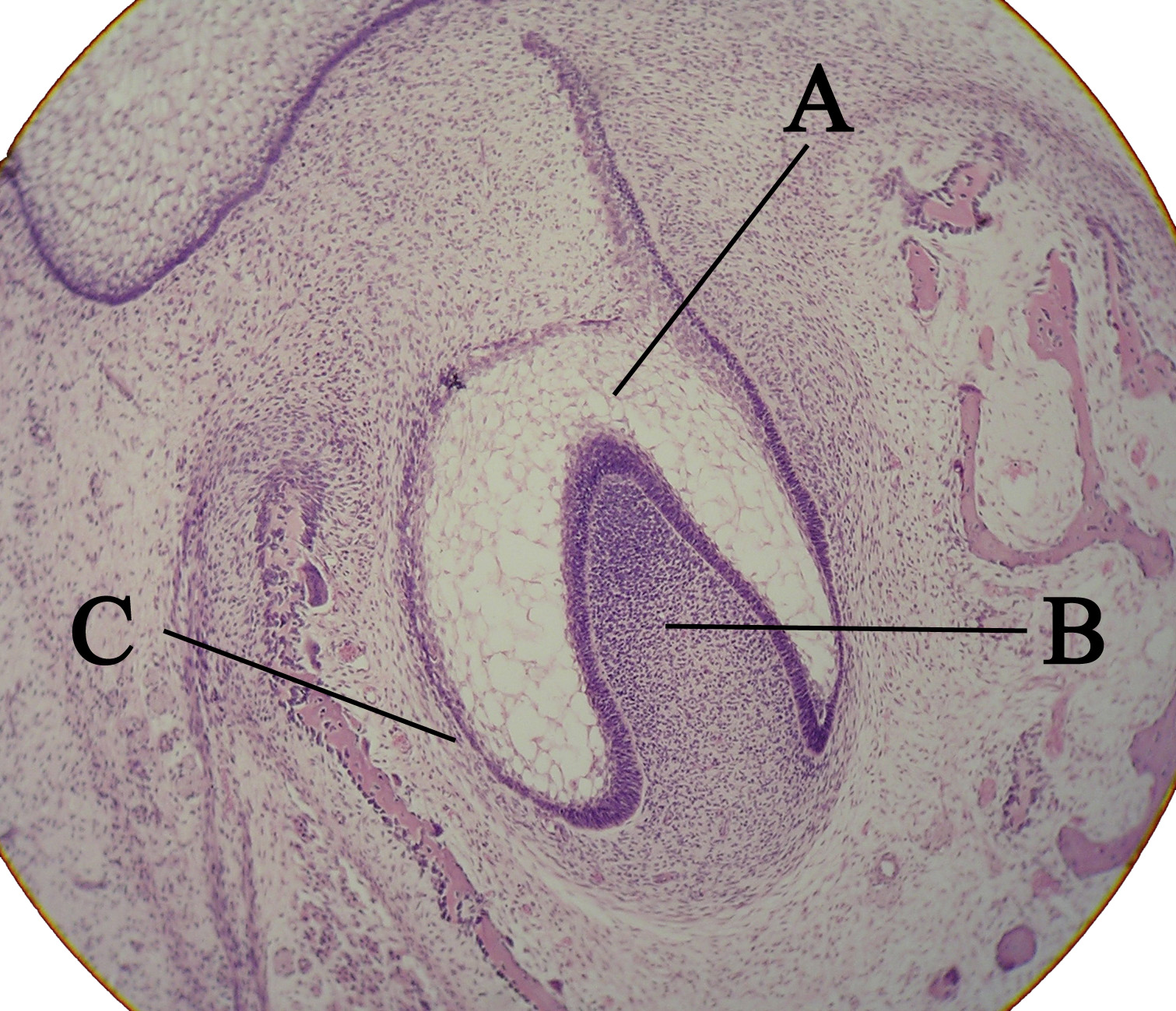 Microscopic view of a tooth bud. A) enamel organ. B) dental papilla. C) dental follicle.